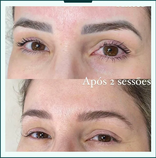 antes depois 01