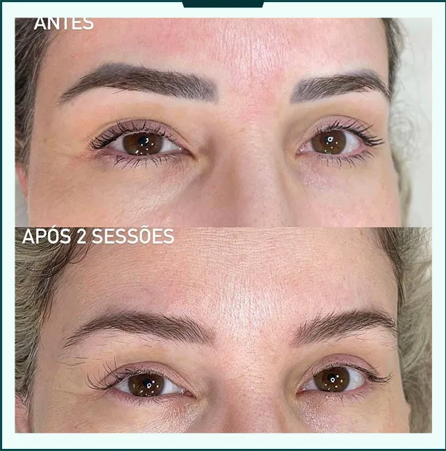 antes depois 02