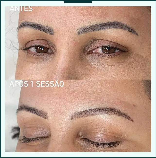 antes depois 04